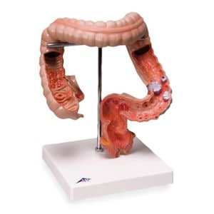 Ĳ������ǥ�