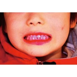 �ץ顼�������å����ʻ�������Ф����ޡ�