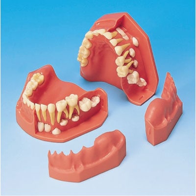 歯列発育模型 (3・6歳児)