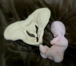 骨盤＋胎児人形 助産実習セットA