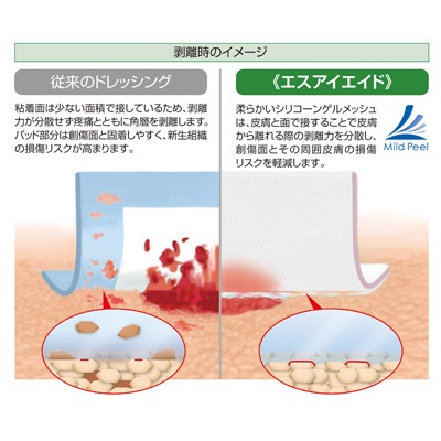 エスアイエイド