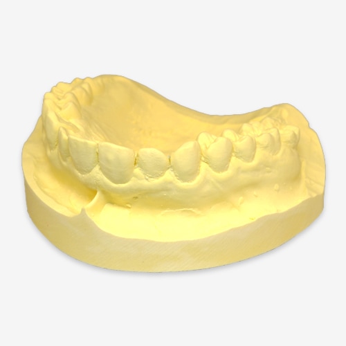 歯科技工(株)日本歯科工業社製 木村工作所 M・I開口器(専用箱 栞付)歯科医院保管品 g19080723 注目商品PICK UP | 歯科材料・器械の株式会社田中歯科器械店