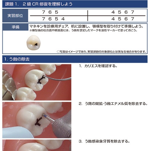 歯冠修復治療のテクニカルリクワイヤメント 書籍詳細「歯冠修復治療のテクニカルリクワイヤメント