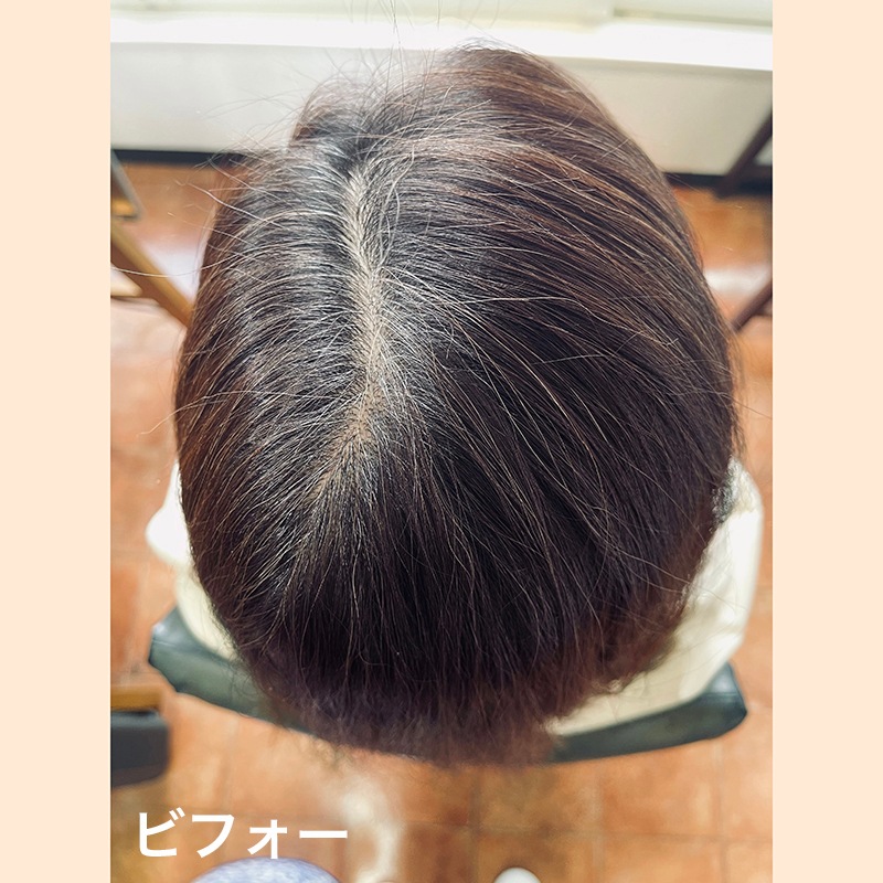 �ڥͥ��ݥ����ѡۤ��󤿤�إʥ��꡼�������顼����ǥ���ʡ�