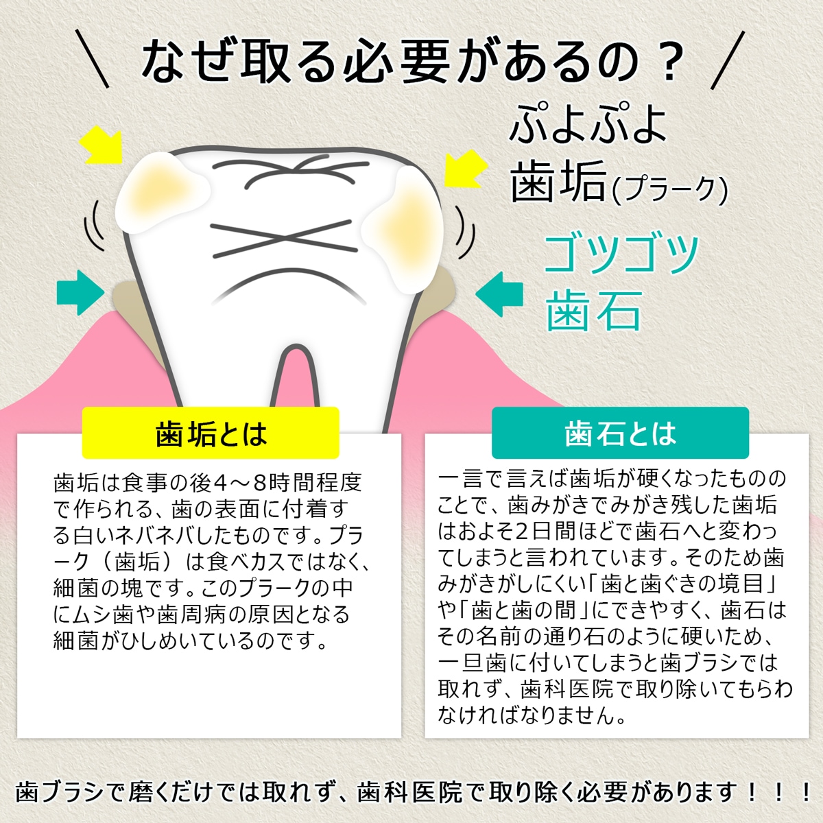 スケーラー 歯石取り-ME016