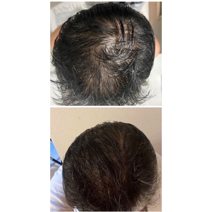 詰替】ニーゲンキ ヒト幹細胞mist｜ホームケアのことならマツエク商材