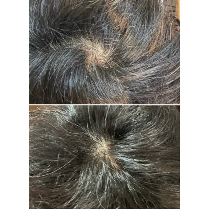 詰替】ニーゲンキ ヒト幹細胞mist｜ホームケアのことならマツエク商材