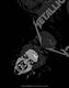METALLICA (᥿ꥫ) Undead ֥ǥåɡץХ