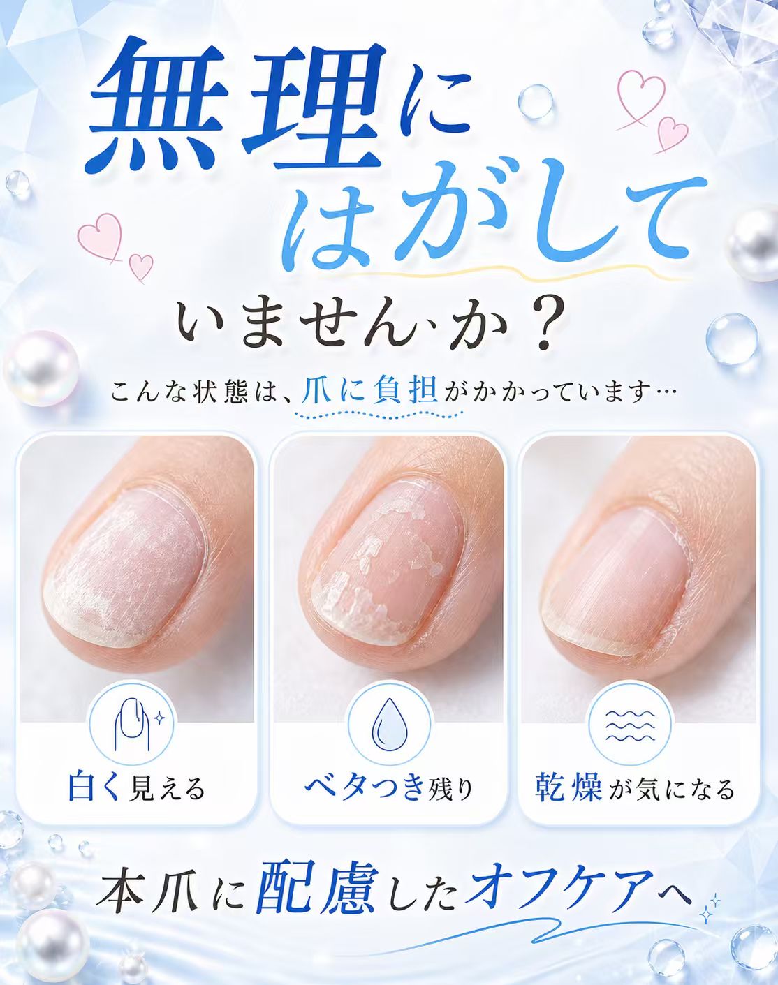 スピードフィットジェル・リムーバー