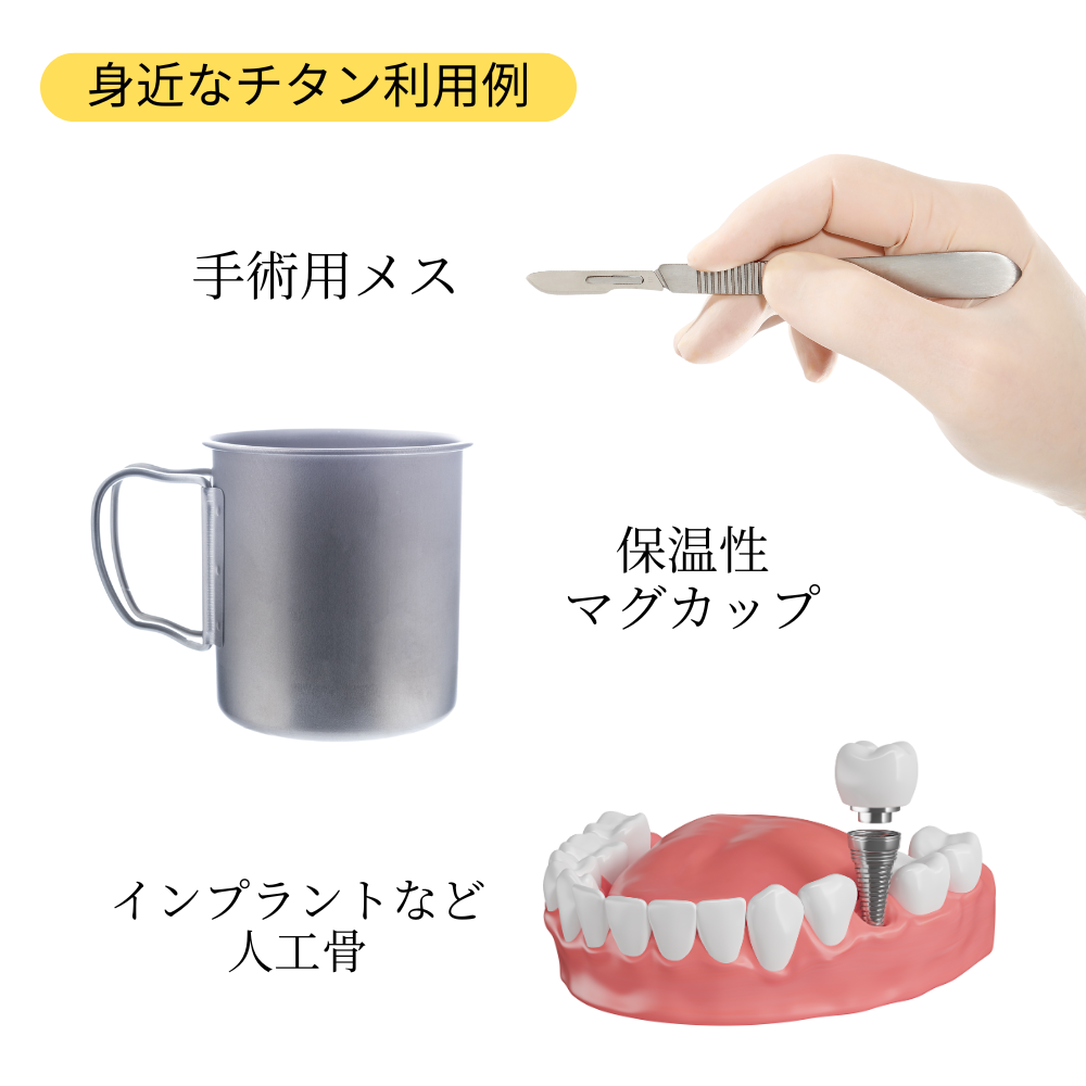 �����쥯�ȥ�����γ