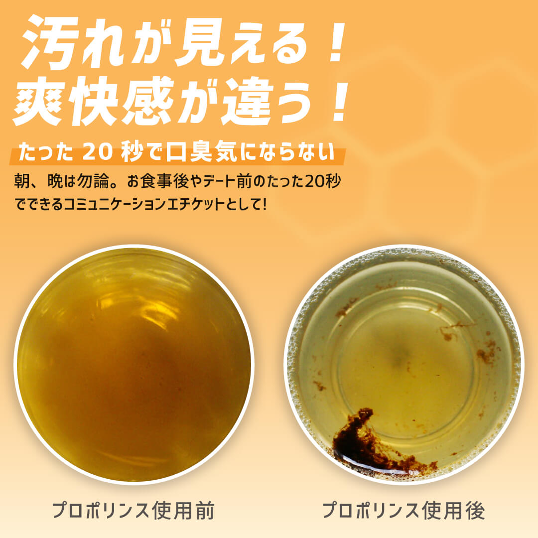 �ڸ���/�ե��ߥ꡼�ۥץ��ݥ�� �����ȥ��å�