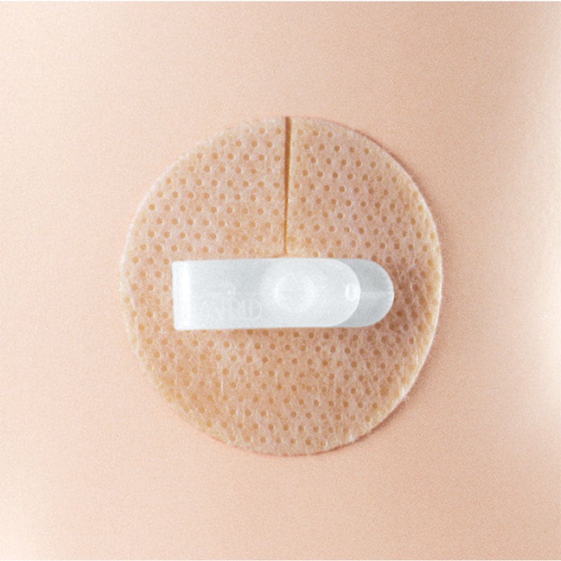 アルケア ペグケアー（PEG後用皮膚保護剤）(20枚入り）