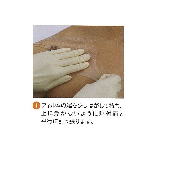 医療 介護用品の通販サイトハートプラス 防水フィルム Iv3000ドレッシング フレームデリバリータイプ 各種 医療 介護用品の通販サイトハートプラス 防水フィルム Iv3000ドレッシング フレームデリバリータイプ 各種