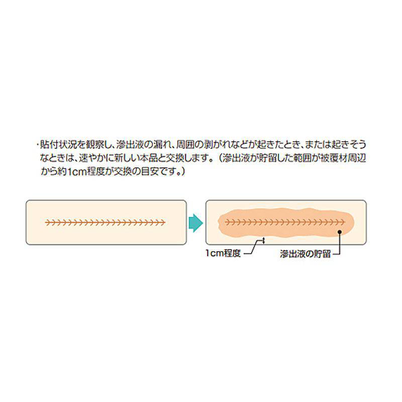 アルケア ハイドロコロイド創傷被覆材 カラヤヘッシブ・クリアータイプ 【各種】