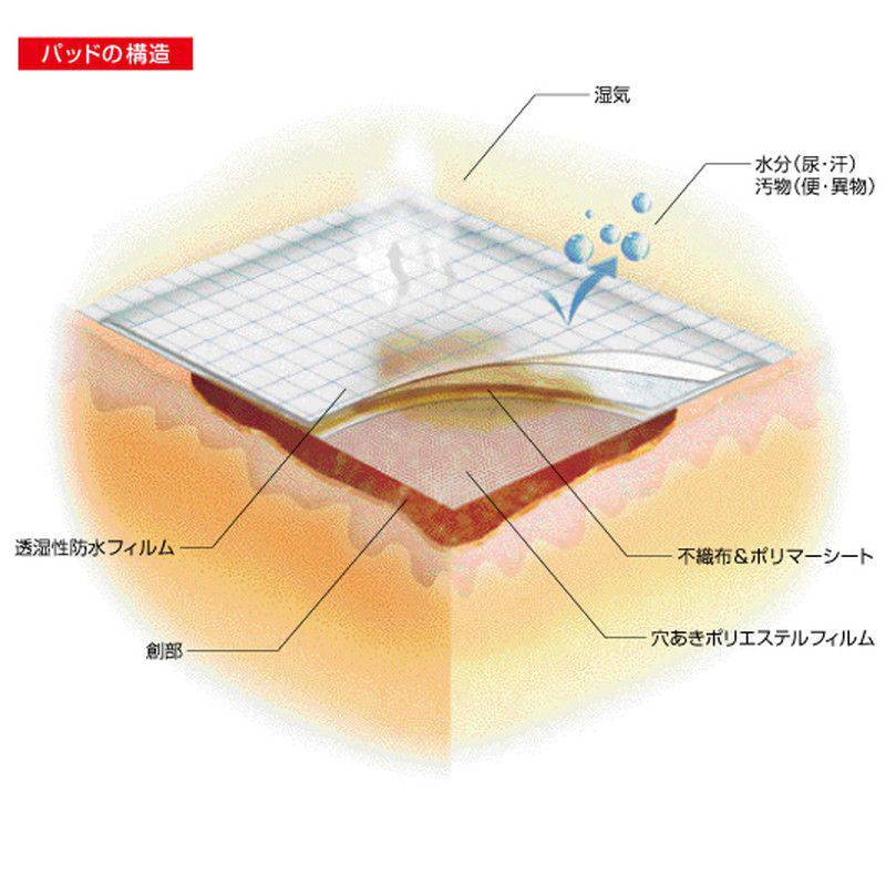 白十字 パッド付防水フィルム モイスキンパッド 滅菌済 【各種】