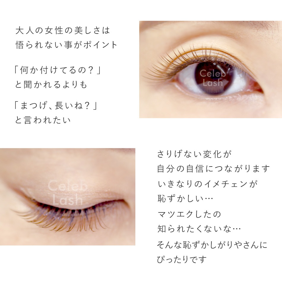 ���ץ�ߥ��ॻ��֥�å��� 0.05mm 10��« ���祳�֥饦��  �ڥ᡼���زġ�