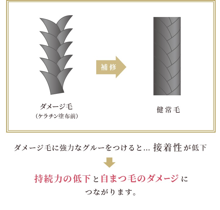 ۥꥹƥå ker١1 (4mL)2ܥå ڥ᡼زġ