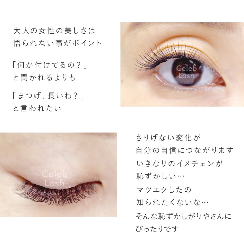 ���ץ�ߥ��ॻ��֥�å��� �ڥ᡼���زġ�