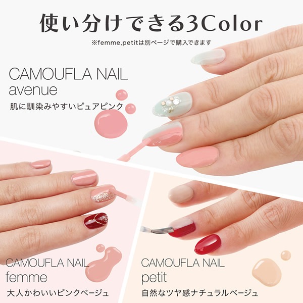 ����ե�ͥ���avenue �Ϥ�����ͥ����ѥ��󥷡��顼 �ͥ��� ���� �ͥ���NG �ͥ��륱�� ���� �ܵ� ������� �� ����ե顼���� ���ǡ�