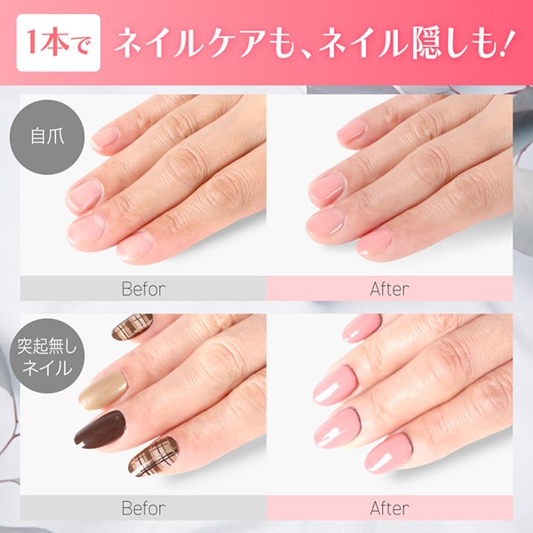 ����ե�ͥ���avenue �Ϥ�����ͥ����ѥ��󥷡��顼 �ͥ��� ���� �ͥ���NG �ͥ��륱�� ���� �ܵ� ������� �� ����ե顼���� ���ǡ�