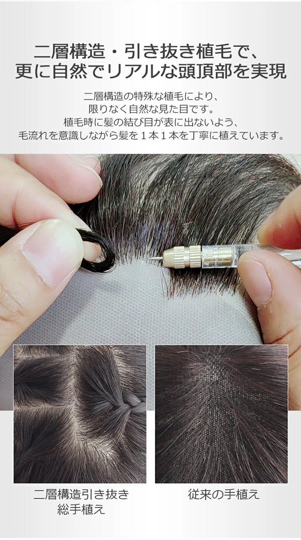 �丵�� ���� ��ʬ�����å� BHADS812-25 �ݥ���ȥ����å� ��ȱ������ �Ĥ��� �ȥåץ��С� ���� ��ǥ����� �Ĥस�դ� ��ߡ��إ��� ��ߡ��إ� ���� �ʥ����� �إ��ԡ��� Ƭĺ�� ��ȱ���� ��ȱ���С� ���ߥ��� �դ��� �����к�