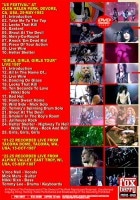 MOTLEY CRUE / LIVE WIRE 80'S (1DVD-R) FOXBERRY / FBVD-040