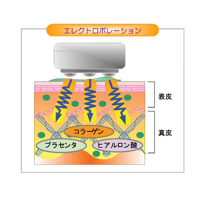 Beauternal ビュータナル Dr.Venus美顔器 日本製 純チタンヘッドの簡単