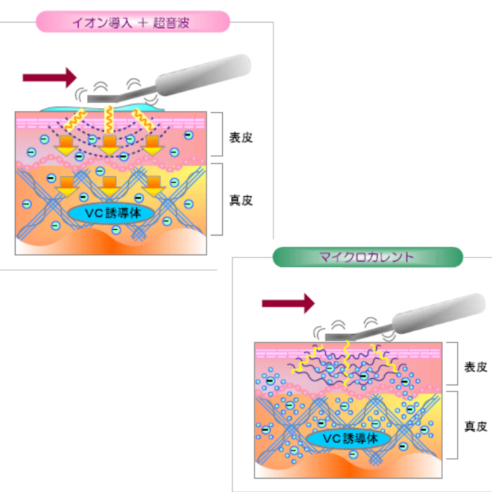 Beauternal ビュータナル Dr.Venus美顔器 日本製 純チタンヘッドの簡単