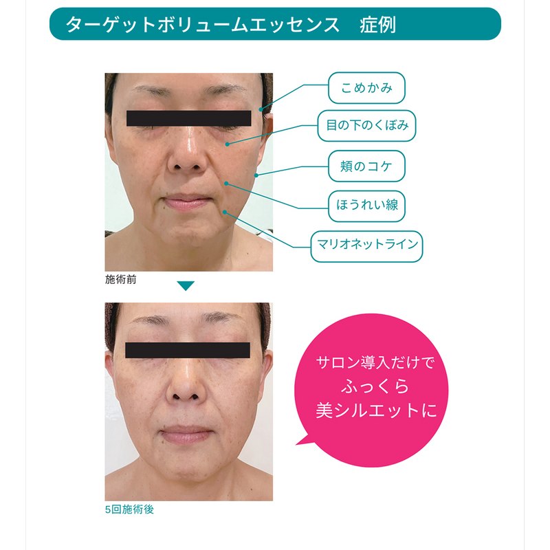 PEPTIDERM ターゲットボリュームエッセンス 50mL 美容液 ペプチダーム ターゲットボリュームエッセンス 50mLの通販｜美セラ
