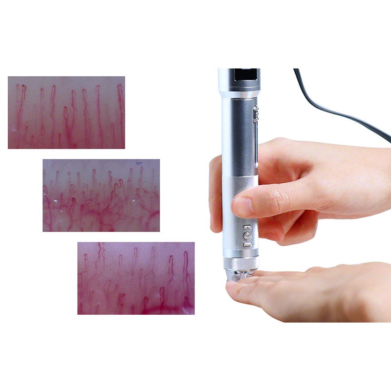 血流解析ソフト 「Viewty Eva ビューティー エヴァ」 VIEWTYEVA