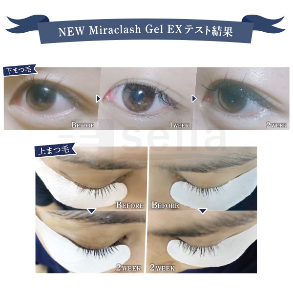 CKL ミラクラッシュ ジェル EX 【11本+1本サービス】