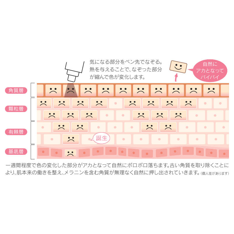 シミケア機器 REAGE（リアージュ）シミ・そばかす・肝斑の通販｜美セラ