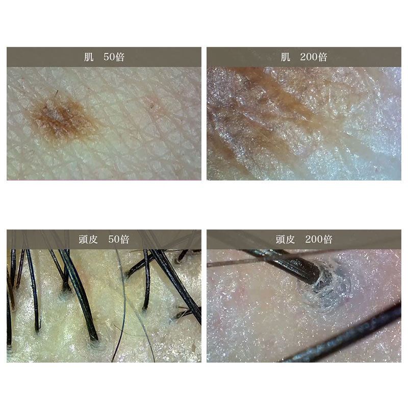 ワイヤレスマイクロスコープ 3R-WMBTEG 肌質診断