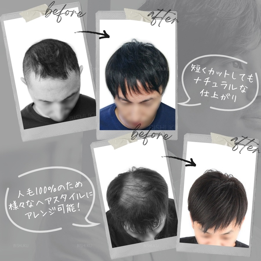  ʬå 100% ܻž夲 ʼ 15cm  إԡ (Men's M/L)