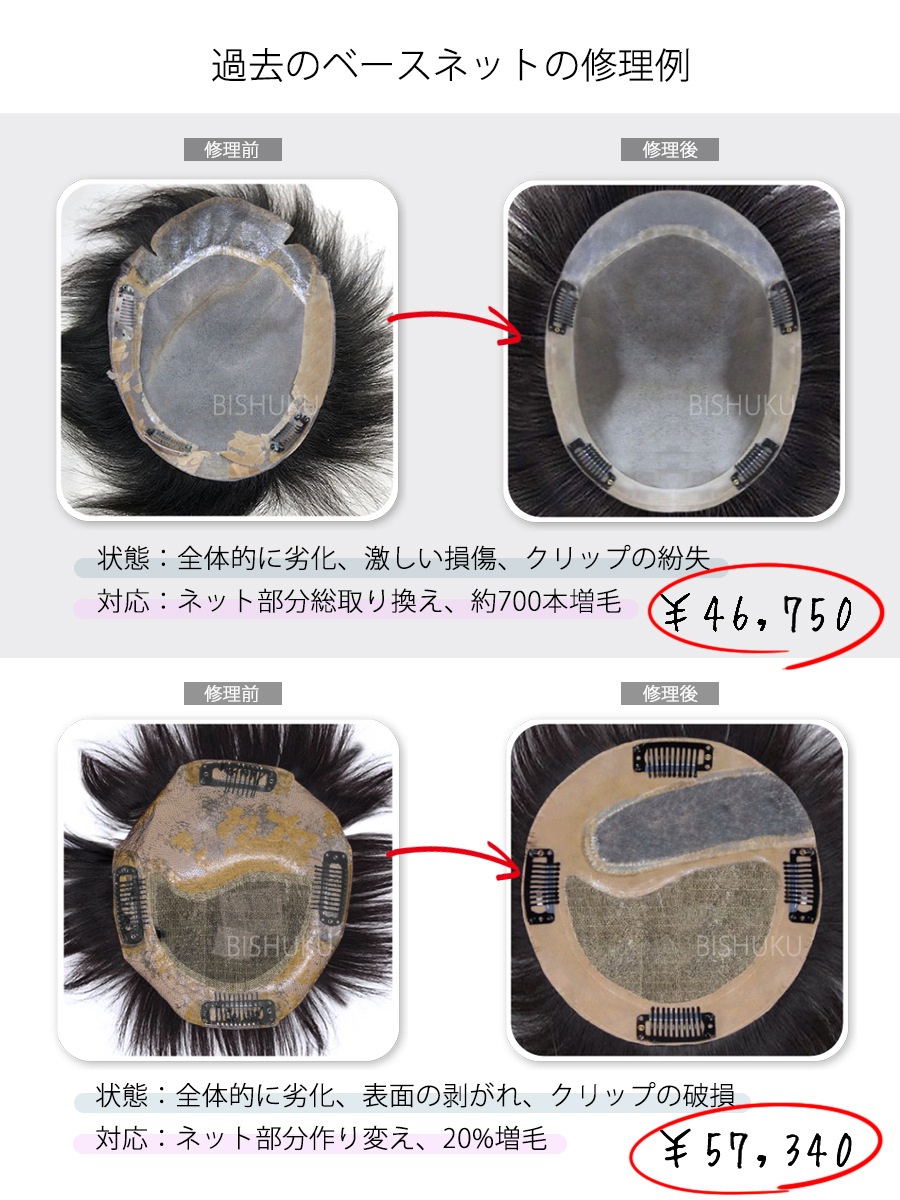 �����å� ���� ���� ��ڥ� ���� �ͥå��ˤ� ���᡼�����б� �إ��ԡ��� (repair)