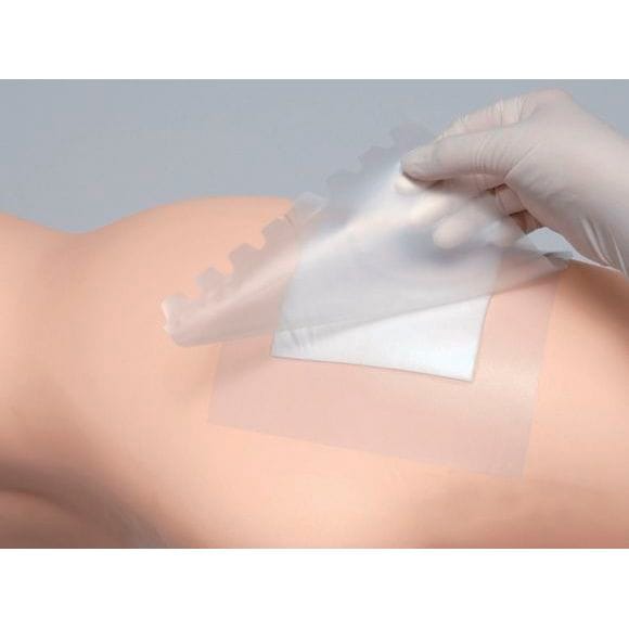 新品未使用　5箱　マルチフィックスロール10号 マルチフィックス・ロール 5.0cm×10m 5号 アルケア 透湿 防水性