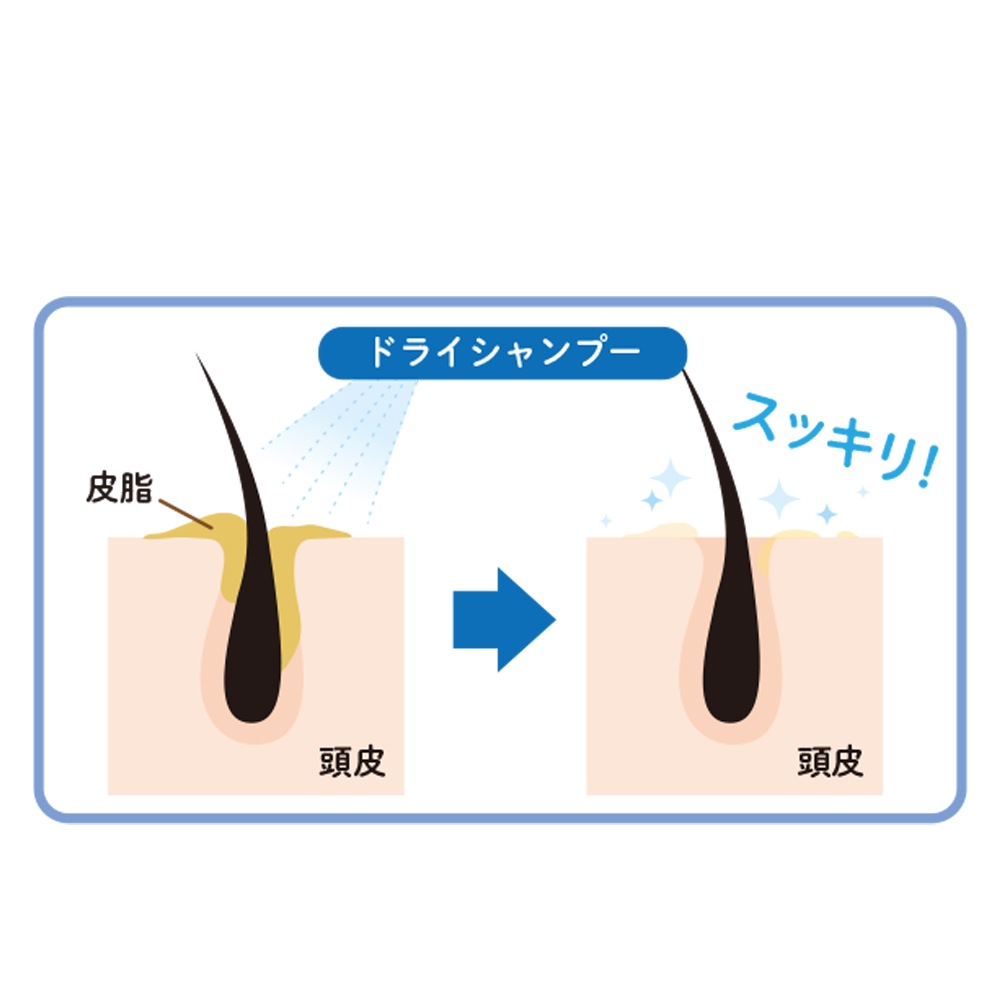 【母の日クーポン対象】100年快適生活 水のいらないドライシャンプー 200ml
