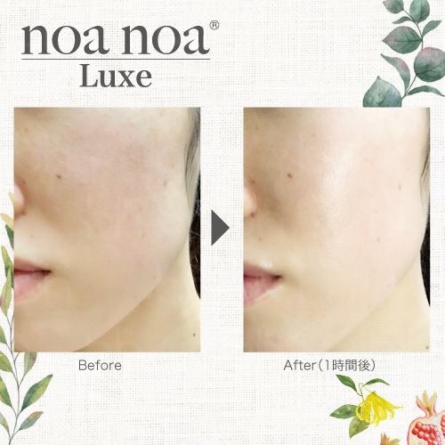 noa noa Luxe（ノア ノア リュクス） CO2 スキンミスト150g