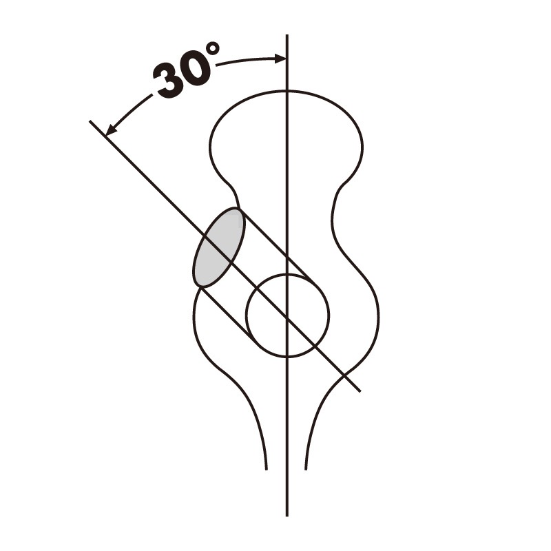 ڥȥåоݾ 30HERM SPRENGERʥϡॹץ󥬡 ڥ 42262