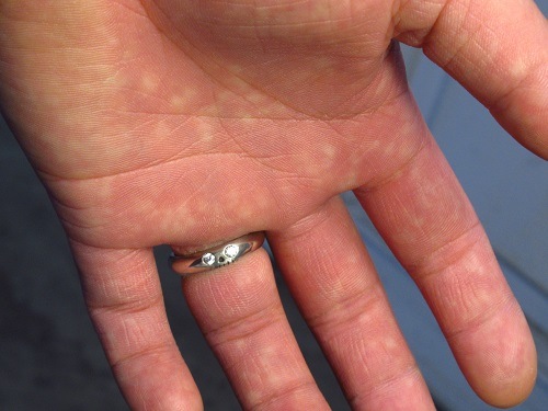 FUNNY SKULL RING/L STONE