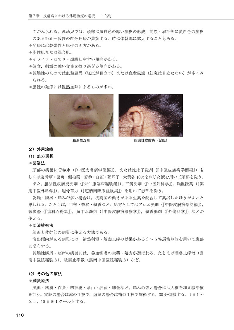 ［簡明］中医外用治療