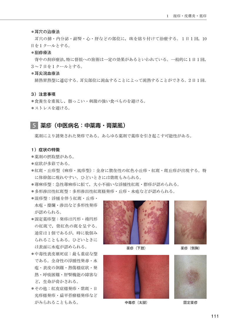 ［簡明］中医外用治療