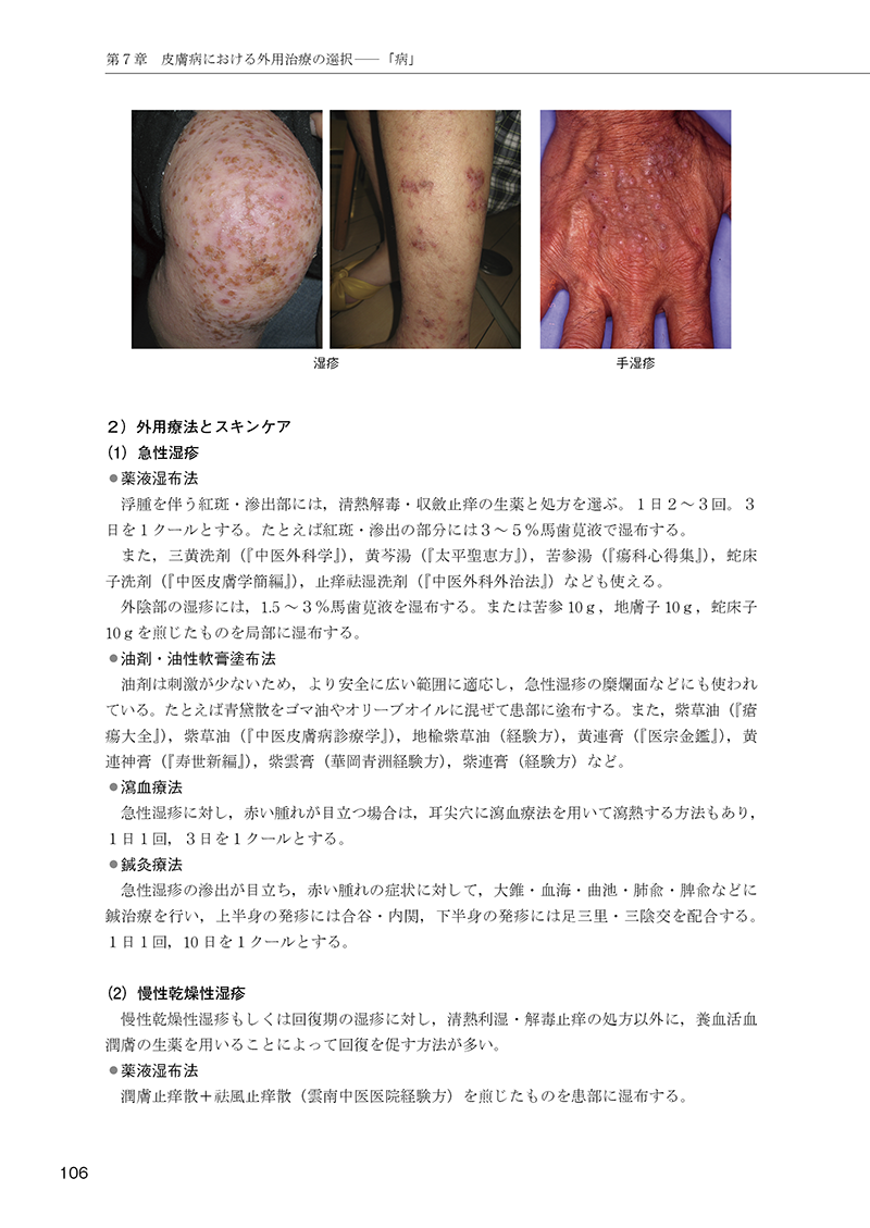 ［簡明］中医外用治療