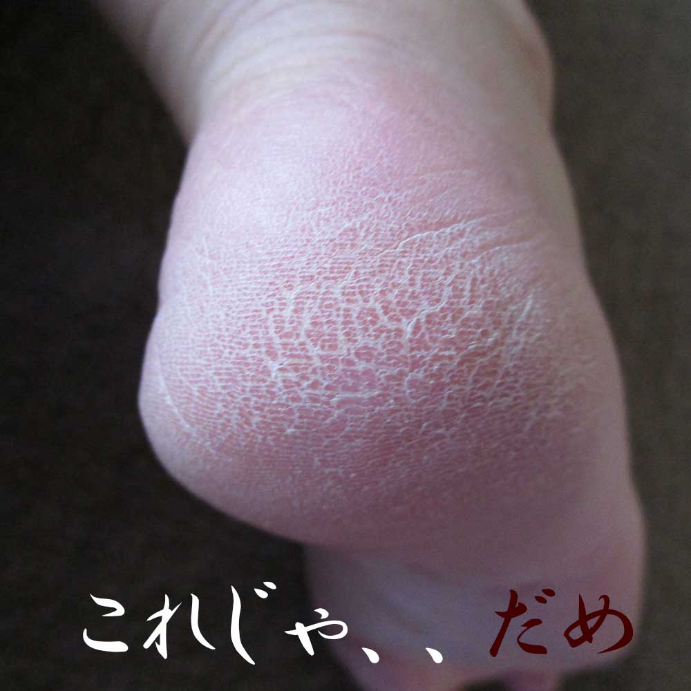 かかとにうっとりするくりーむ