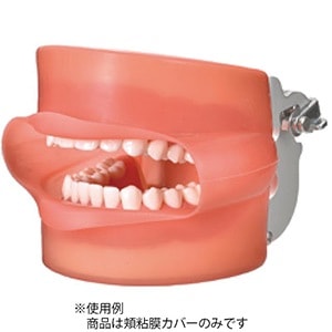 歯牙着脱模型 頬粘膜カバー