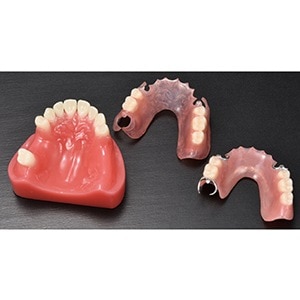 ノンクラスプデンチャー模型 Aタイプ