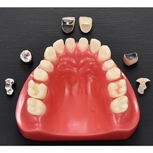 自費・保険比較模型