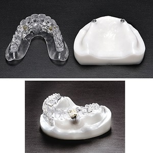 マグネット式デンチャー模型[愛知製鋼]