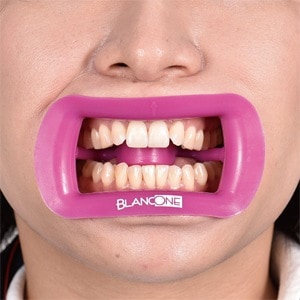 ソフトリトラクター 舌ガード付 L パープル