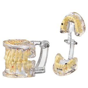 疾患説明用模型(小児)